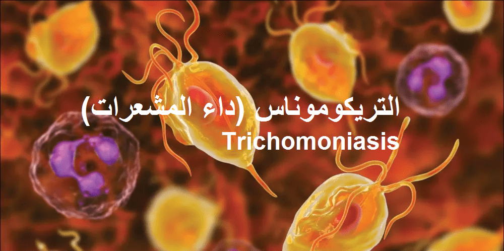 التريكوموناس (داء المشعرات) Trichomoniasis