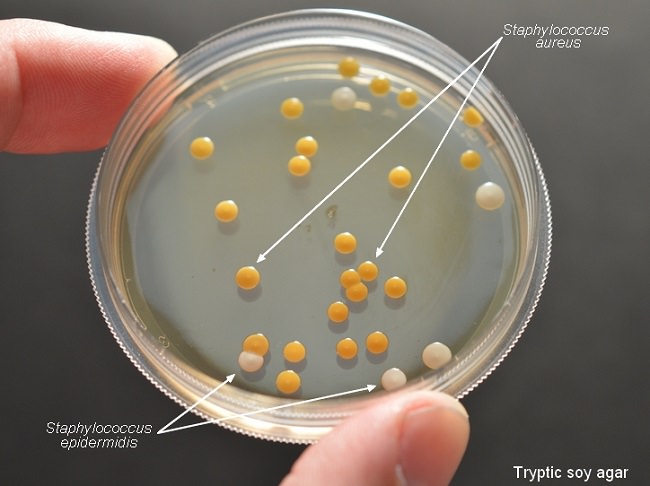 البكتيريا العنقودية البشروية - Staphylococcus Epidermidis