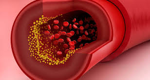 قد يؤدى إلى ارتفاع نسبة الكولسترول وزيادة خطر الإصابة بأمراض القلب