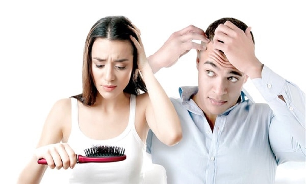 العوامل الوراثية وتساقط الشعر