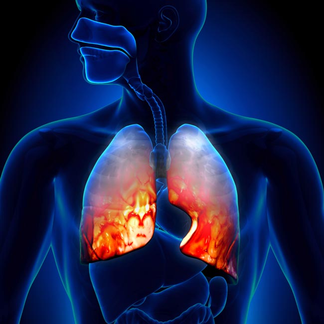 معالجة اضطرابات الجهاز التنفسي